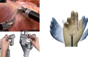 Salud con visión de futuro: la robótica es la cirugía del presente