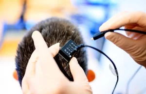 Implantes cerebrales y un avatar digital «devuelven” el habla a una mujer con parálisis