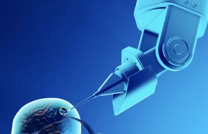 Telepathy, de Elon Musk, el primer chip cerebral implantado a un ser humano