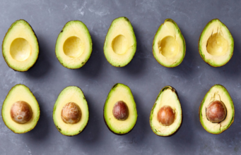Cardiólogo recomienda el aguacate para la salud del corazón